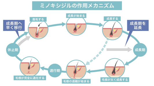 20代から発症するAGAの割合|年齢別の傾向と早期発見・治療の重要性