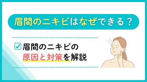 眉間のニキビの原因と対処法を解説！即効性を求める場合の処方薬も紹介