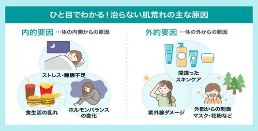 【医師監修】治らない肌荒れを原因タイプ別に解決！正しい対策で肌トラブルを繰り返さない