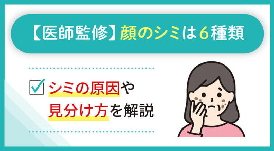 【医師監修】顔のシミは6種類