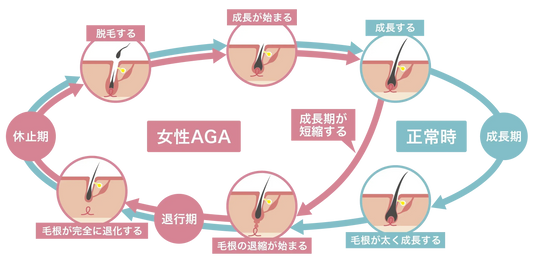 女性が急に抜け毛が増えたときに考えられる原因と対策