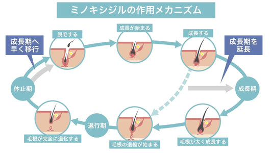 20代から発症するAGAの割合｜年齢別の傾向と早期発見・治療の重要性